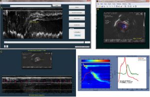 UltrasoundX